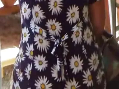 កូនមាន់ដែលមានដុំពក